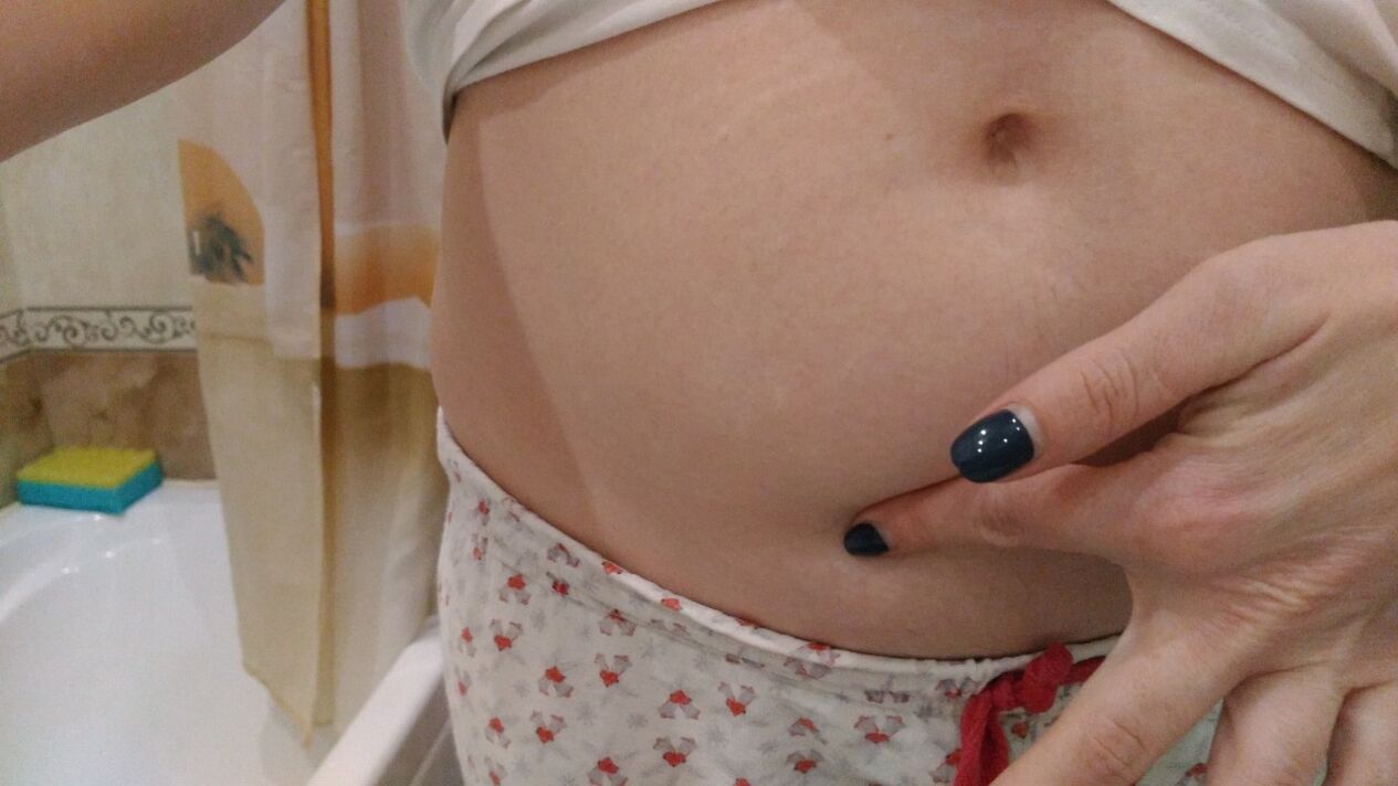 Helmintu infekcijas pazīmes no personīgās pieredzes