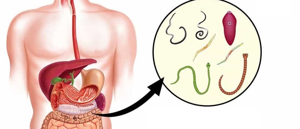 Parazīti cilvēka organismā