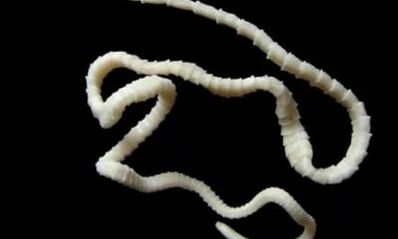 kā noņemt cestodes parazītu no ķermeņa