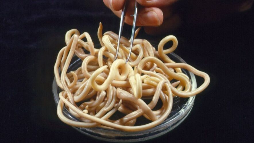 parazīti no cilvēka ķermeņa