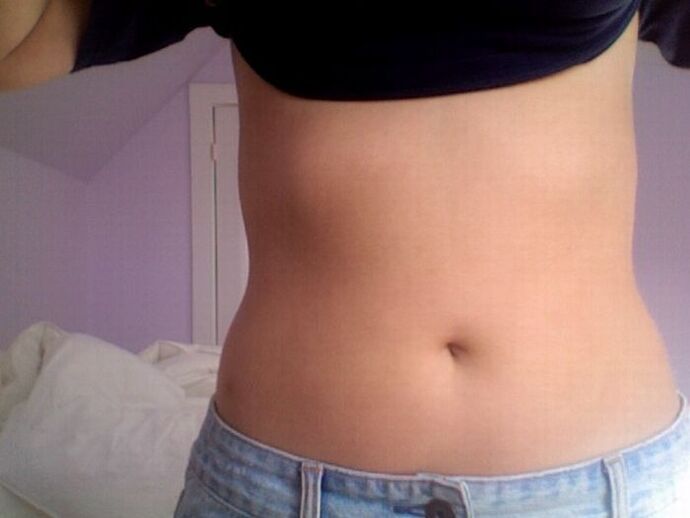 Ārstēšanas ar NEOflorax kapsulām rezultāts